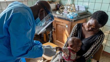 Baby is attended by doctor in Lwiro hospital, DR Congo