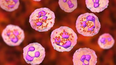 Meningococcal meningitis. Computer illustration showing cerebrospinal fluid containing numerous neutrophils with Neisseria meningitidis bacteria inside.