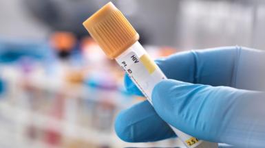 A stock image of a blue gloved hand holding a vial with HIV written on the label