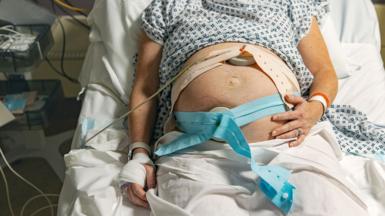 Stock photo shows a pregnant woman lying on a hospital bed hooked up to care machines ahead of giving birth.
