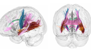 Major tracts of white matter in the brain show evidence of increasing during pregnancy