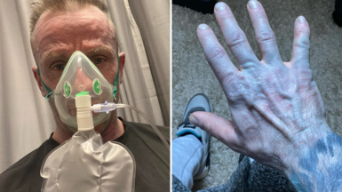 Split picture of Scott Lynch wearing an oxygen mask and another pic of his blue hand