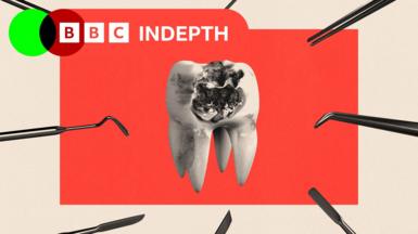 A treated image of a singular tooth with an infection. It is surrounded by dentistry tools.