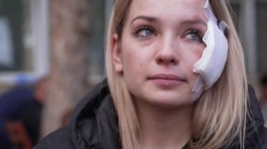 Marija has tears in her eyes and a bandage on her face