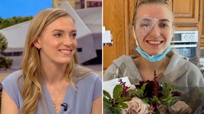 Composite image showing Ellie Irwin on the left with her hair down on the Breakfast sofa and Ellie on the right after surgery.