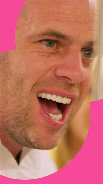 A man, Martin, shows off his new teeth. His mouth is open and he has a stubbly beard.