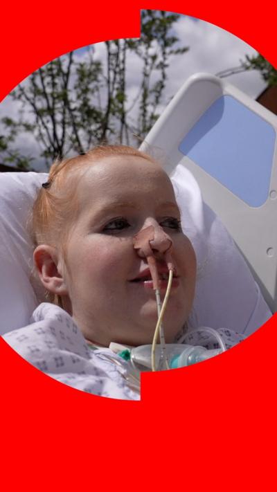A woman with very short ginger hair lies in a hospital bed with a feeding tube connected to her nose