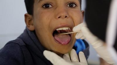 Yemeni diphtheria patient