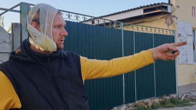 Man with bandaged head points into distance