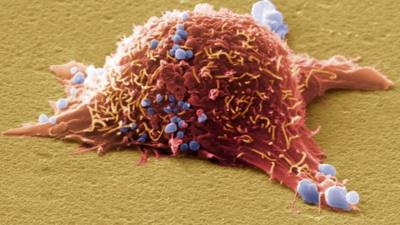 Melanoma cancer cell