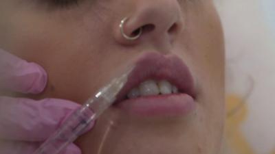 Woman having lip filler