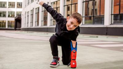 Kaden does a Spider-Man pose with his bionic arm