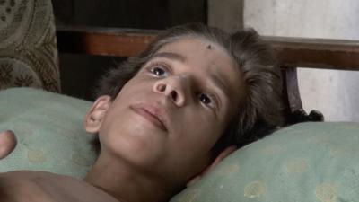 Injured boy in Aleppo