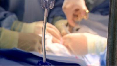 Surgeons hands during transplant operation