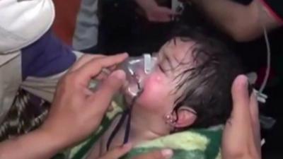 A Syrian girl receiving treatment after an alleged chemical attack in Sarmin, Syria