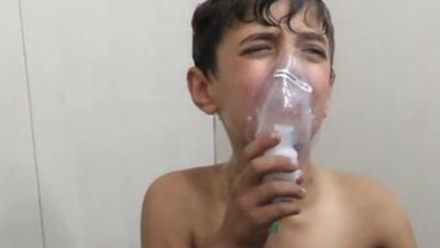 A boy is treated for breathing difficulties