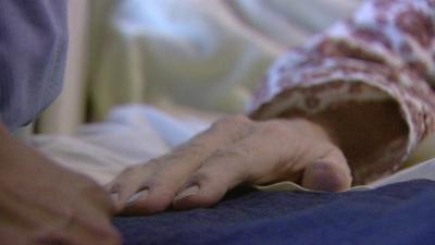 Close up of an elderly patient's hand