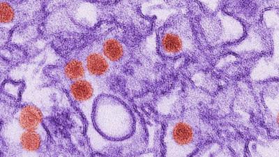 Zika virus under microscope