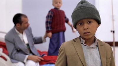 Children at a cancer hospital in Sanaa, Yemen