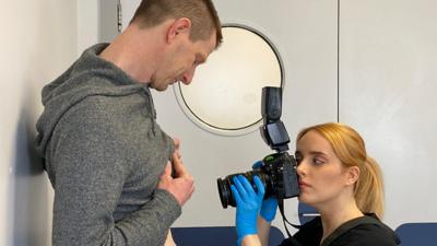 Video showing teledermatology in Blackpool