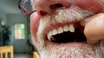 Debroy Parrington shows gap in his teeth.