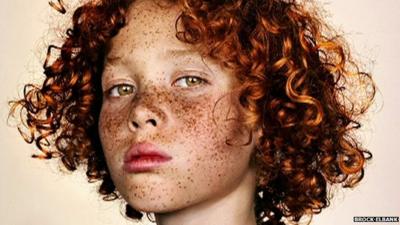 Boy with freckles