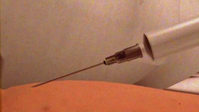 Hypodermic syringe piercing skin