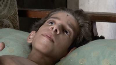 Injured boy in Aleppo