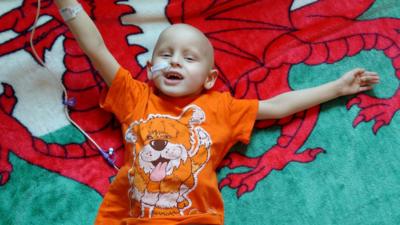 Cian lying on a welsh flag during treatment