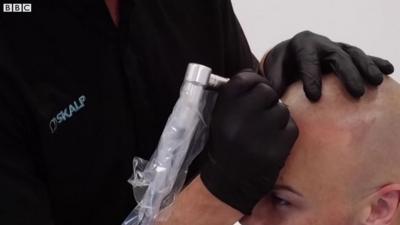 A man having his head tattooed