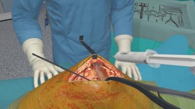 VR Surgery