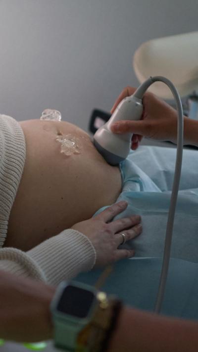 A woman during a pregnancy ultrasound scan
