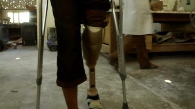 Prosthetic limb