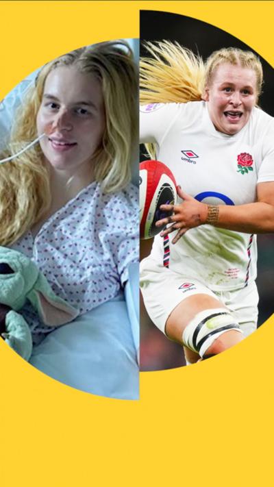 A split screen image. On the left, Abi Burton lying on a hospital bed. On the right, Abi Burton in a white England rugby kit.