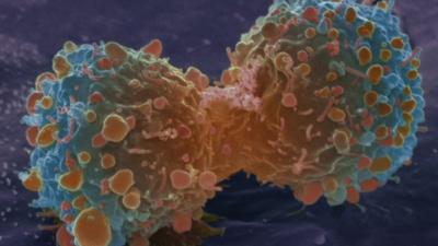 Cancer cell