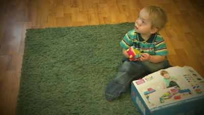 Maesteg toddler, Ollie, who was born with a rare facial condition