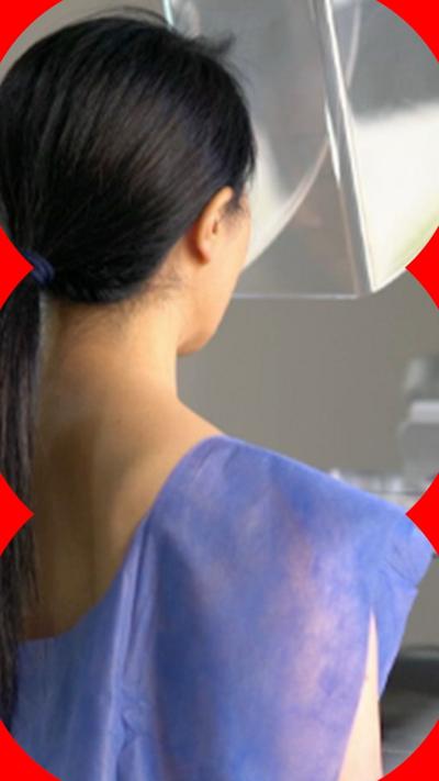 Person in a medical gown undergoes a mammogram screening.