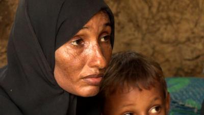 A woman displaced by the crisis in Yemen