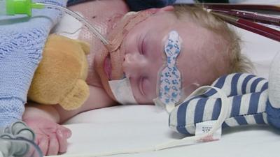 A candlelit vigil is held for baby Carter Cookson, who desperately needs a new heart.