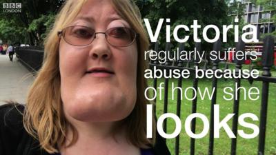 Victoria Wright on living with facial disfigurement