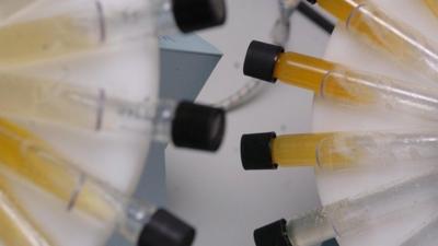 Urine sample test tubes