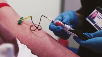 A blood test being done on Henry's arm