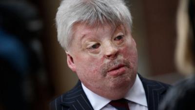 Simon Weston