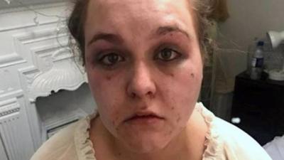 Kirby Weegram was beaten with a piece of wood during a six-hour attack by her partner.