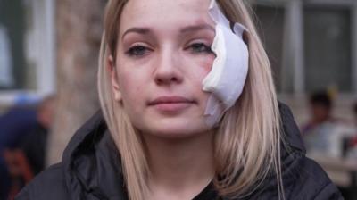 Marija has tears in her eyes and a bandage on her face