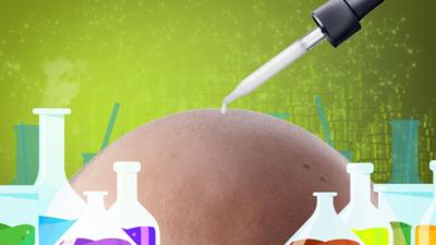 Artwork depicting a pipette dropping liquid onto a bald head surrounded by glass beakers