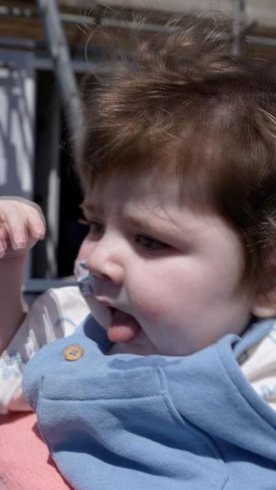 Baby Jack, who has a genetic condition