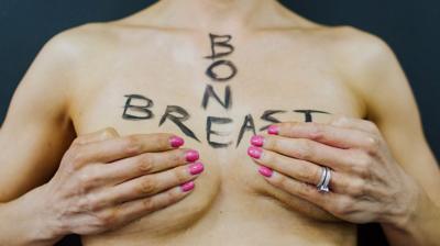 Breast Cancer