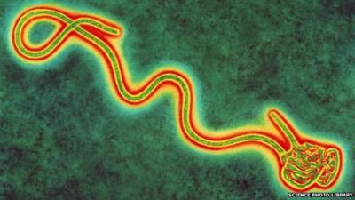Coloured transmission electron micro-graph of a single Ebola virus, the cause of Ebola fever.