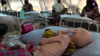 Hundreds of thousands of people in northern Nigeria are suffering from acute malnutrition, warns the UN.